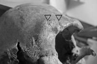 Рис.4. Вероятная травма лобной кости над левой орбитой. Мужчина (МАЭ №5773-17, погр.65). Фото автора.